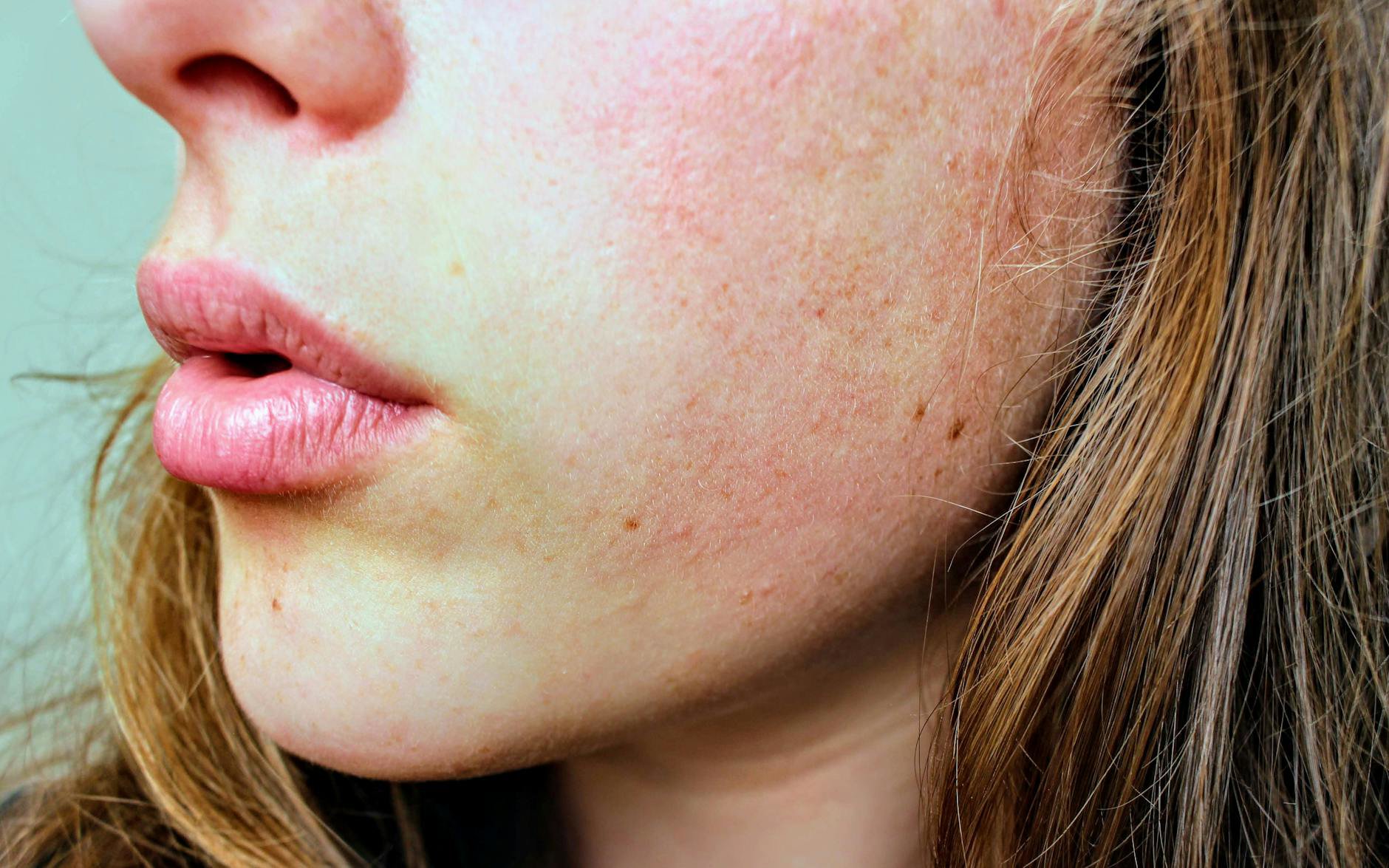 close up skin texture cheek pores