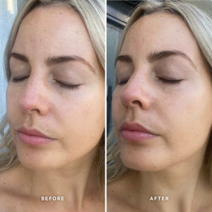 Alpha-H Vitamin E Serum With 1% Ceramide Complex
