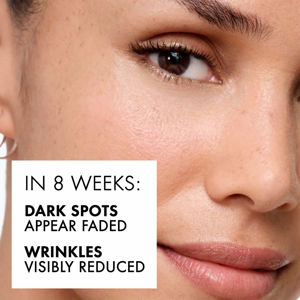 Vichy Liftactiv Specialist B3 5% Niacinamide & Aha Complex Dark Spots & Pigmentation Serum