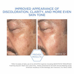 NeoStrata Foaming Glycolic Wash Aha 20