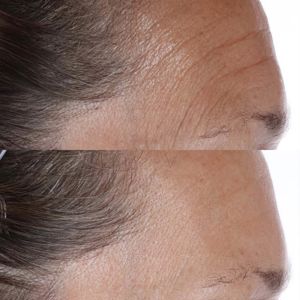 Perricone MD Essential Fx Acyl-Glutathione Chia Oil - Face Oils 3